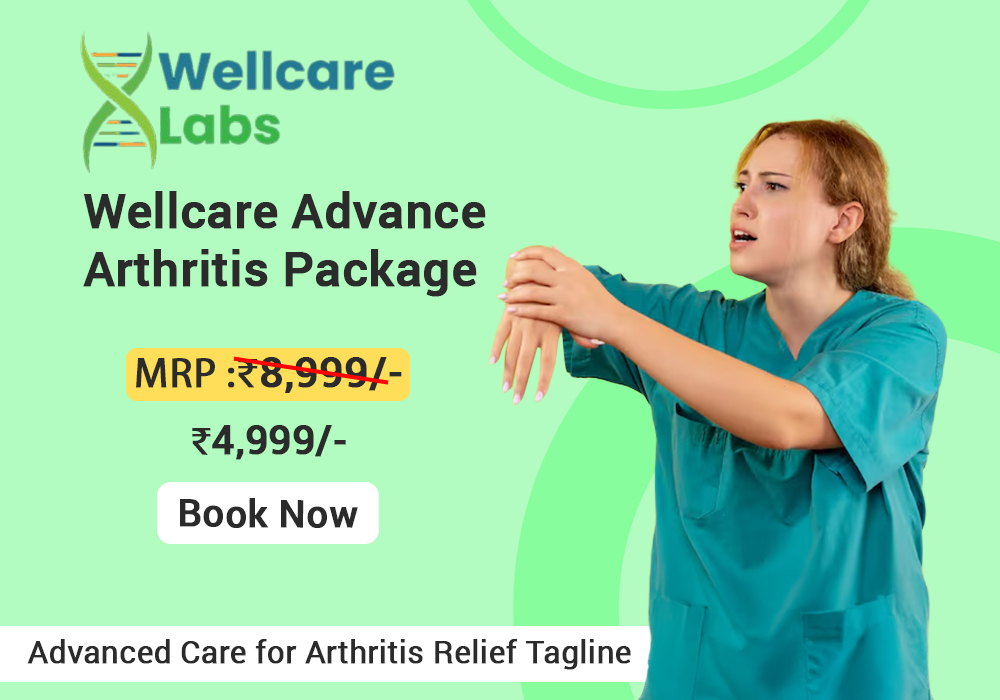 Wellcare Advance Arthritis Package